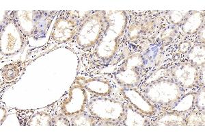 Detection of HIF1a in Human Kidney Tissue using Monoclonal Antibody to Hypoxia Inducible Factor 1 Alpha (HIF1a) (HIF1A antibody  (AA 218-506))