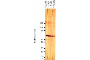 Western Blotting (WB) image for anti-Cytomegalovirus p65 (CMV p65) antibody (ABIN265537) (CMV p65 antibody)