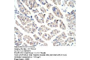 Rabbit Anti-ACO1 Antibody  Paraffin Embedded Tissue: Human Muscle Cellular Data: Skeletal muscle cells Antibody Concentration: 4. (Aconitase 1 antibody  (N-Term))