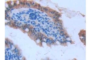 #VALUE! (FABP2 antibody  (AA 2-132))