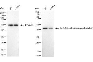 Western blotting analysis using Acyl-CoA dehydrogenase short chain antibody (ABIN7797493).