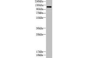 Western Blot All lanes: CCDC103 antibody at 5 μg/mL + Mouse heart tissue Secondary Goat polyclonal to rabbit IgG at 1/10000 dilution Predicted band size: 28, 12 kDa Observed band size: 111 kDa (CCDC13 antibody  (AA 1-242))