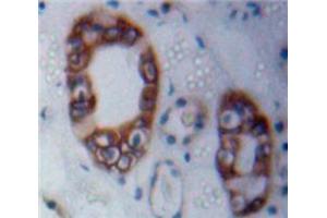 Used in DAB staining on fromalin fixed paraffin-embedded Kidney tissue (Merlin antibody  (AA 30-311))
