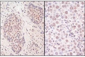 Immunohistochemistry (IHC) image for anti-Structural Maintenance of Chromosomes Flexible Hinge Domain Containing 1 (SMCHD1) (AA 1955-2005) antibody (ABIN7453788)