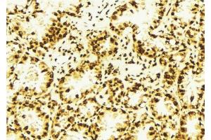 ABIN6277741 at 1/100 staining Human lung tissue by IHC-P. (ASH2L antibody  (Internal Region))