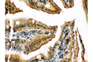 Anti- RAB13 Picoband antibody, IHC(P) IHC(P): Mouse Intestine Tissue (RAB13 antibody  (C-Term))