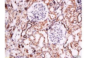 Formalin-fixed and paraffin embedded human kidney labeled with Anti- Pan FOXD Polyclonal Antibody, Unconjugated  at 1:200 followed by conjugation to the secondary antibody and DAB staining.