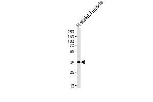 Western blot analysis of lysate from human skeletal muscle tissue lysate, using PPP1R3B Antibody at 1:1000 at each lane.