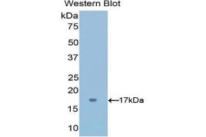 Detection of Recombinant IFNg, Mouse using Polyclonal Antibody to Interferon Gamma (IFNg) (Interferon gamma antibody  (AA 23-155))