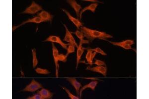 Immunofluorescence analysis of HeLa cells using LGMN Polyclonal Antibody at dilution of 1:100 (40x lens). (LGMN antibody)