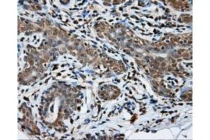 Immunohistochemical staining of paraffin-embedded breast tissue using anti-NPR3 mouse monoclonal antibody. (NPR3 antibody)