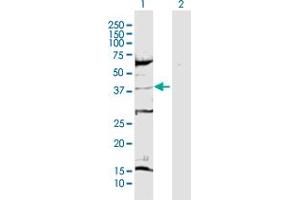 Western Blot analysis of CDK6 expression in transfected 293T cell line by CDK6 MaxPab polyclonal antibody. (CDK6 antibody  (AA 1-326))