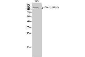 Western Blotting (WB) image for anti-TEK Tyrosine Kinase, Endothelial (TEK) (pTyr992) antibody (ABIN3182332) (TEK antibody  (pTyr992))