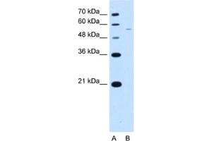 Western Blotting (WB) image for anti-arginine/serine-Rich Coiled-Coil 2 (RSRC2) antibody (ABIN2463413)