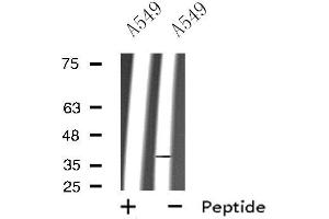 Western blot analysis of extracts from A549 cells, using RHO antibody. (Rho-related GTP-binding protein antibody)