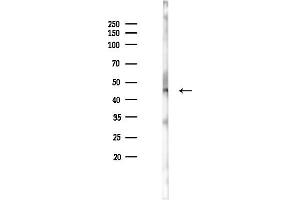 anti-Gastrin-Releasing Peptide Receptor (GRPR) (Internal Region) antibody