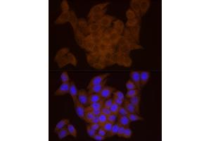 Immunofluorescence analysis of HeLa cells using DTYMK Rabbit mAb (ABIN7266735) at dilution of 1:25 (40x lens).