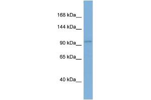 WB Suggested Anti-EIF2C1 Antibody Titration: 0. (AGO1 antibody  (N-Term))