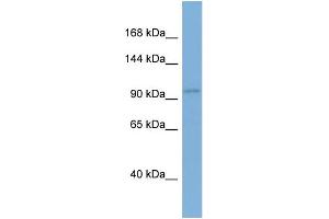 WB Suggested Anti-EIF2C1 Antibody Titration: 0.