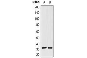 Western blot analysis of SIAH1/2 expression in HeLa (A), Jurkat (B) whole cell lysates. (SIAH1/2 antibody  (Center))