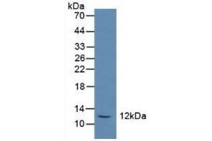 Detection of SST in Rat Serum using Polyclonal Antibody to Somatostatin (SST) (Somatostatin antibody  (AA 27-116))