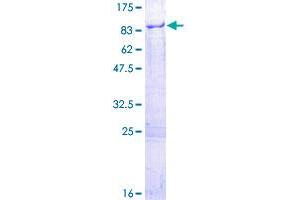 MPP7 Protein (AA 1-576) (GST tag)