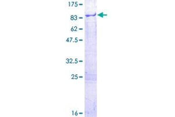 MPP7 Protein (AA 1-576) (GST tag)