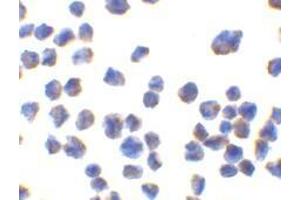 Immunocytochemistry of CTRP7 in 293 cells with AP30260PU-N CTRP7 antibody at 10 μg/ml. (CTRP7 antibody)