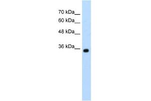 WB Suggested Anti-ZMYND11 Antibody Titration:  1.