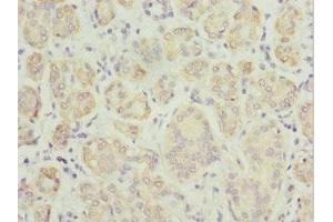 Immunohistochemistry of paraffin-embedded human salivary gland tissue using ABIN7173912 at dilution of 1:100 (TPD52L1 antibody  (AA 1-144))