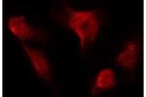 ABIN6275989 staining HUVEC by IF/ICC. (FSHR antibody  (Internal Region))