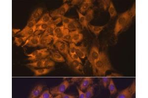 Immunofluorescence analysis of C6 cells using RPL17 Polyclonal Antibody at dilution of 1:100. (RPL17 antibody)