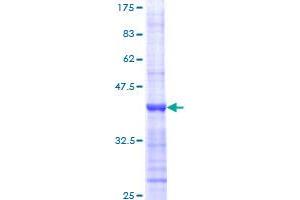 c-MYC Protein (AA 330-439) (GST tag)