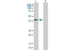 Western Blot analysis of UPP2 expression in transfected 293T cell line by UPP2 MaxPab polyclonal antibody. (UPP2 antibody  (AA 1-317))