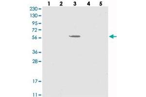 Western blot analysis of Lane 1: RT-4, Lane 2: U-251 MG, Lane 3: Human Plasma, Lane 4: Liver, Lane 5: Tonsil with SLC43A3 polyclonal antibody . (SLC43A3 antibody)