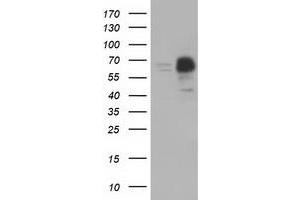HEK293T cells were transfected with the pCMV6-ENTRY control (Left lane) or pCMV6-ENTRY PEX5 (Right lane) cDNA for 48 hrs and lysed. (PEX5 antibody)