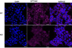 Immunocytochemical staining of HeLa cells using SPTAN1 antibody (ABIN7800418), 1:1,000), Top panel: wild-type (WT), Bottom panal: SPTAN1 shRNA knockdown (KD). (SPTAN1 antibody)