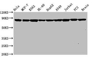 Western Blot Positive WB detected in: Hela whole cell lysate, MCF-7 whole cell lysate, K562 whole cell lysate, HL-60 whole cell lysate, HepG2 whole cell lysate, A549 whole cell lysate, Jurkat whole cell lysate, PC3 whole cell lysate, Rat brain tissue All lanes: Hsp90 alpha antibody at 0. (Recombinant HSP9AA1 antibody)