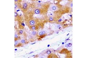 Immunohistochemical analysis of HADH staining in rat liver  formalin fixed paraffin embedded tissue section.