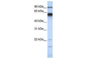 MMP16 antibody used at 1 ug/ml to detect target protein. (MMP16 antibody)