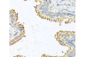 Immunohistochemistry of paraffin-embedded Human prostate using RNASE13 Polyclonal Antibody at dilution of 1:100 (40x lens). (RNASE13 antibody)