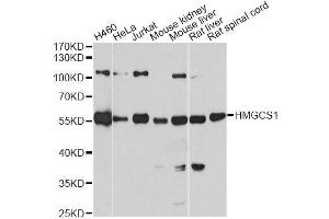 Western blot analysis of extracts of various cell lines, using HMGCS1 antibody. (HMGCS1 antibody  (AA 241-520))