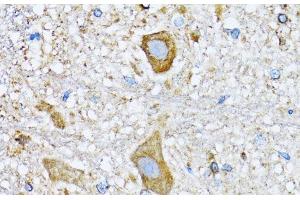 Immunohistochemistry of paraffin-embedded Mouse spinal cord using HDAC5 Polyclonal Antibody at dilution of 1:100 (40x lens). (HDAC5 antibody)