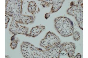 Immunoperoxidase of monoclonal antibody to FUBP1 on formalin-fixed paraffin-embedded human placenta. (FUBP1 antibody  (AA 27-136))