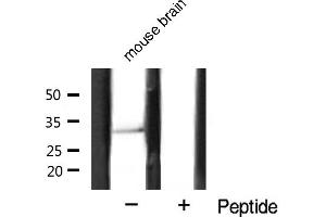 estern blot analysis of Cyclin D1 expression in mouse brain tissue lysates,The lane on the right is treated with the antigen-specific peptide. (Cyclin D1 antibody  (C-Term))