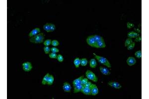 Immunofluorescent analysis of PC-3 cells using ABIN7147218 at dilution of 1:100 and Alexa Fluor 488-congugated AffiniPure Goat Anti-Rabbit IgG(H+L) (EIF3I antibody  (AA 276-486))