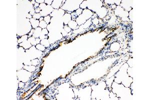 Anti-FGFR3 antibody, IHC(P) IHC(P): Rat Lung Tissue (FGFR3 antibody  (N-Term))