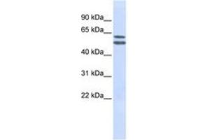 Image no. 1 for anti-Phosphatidylinositol Glycan Anchor Biosynthesis, Class Q (PIGQ) (AA 144-193) antibody (ABIN6740970) (PIGQ antibody  (AA 144-193))