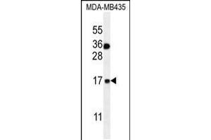 Western blot analysis in MDA-MB435 cell line lysates (35ug/lane). (S100A1 antibody  (C-Term))