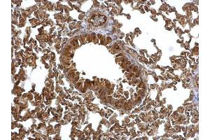 IHC-P Image EML1 antibody [C3], C-term detects EML1 protein at cytosol on mouse lung by immunohistochemical analysis. (EML1 antibody  (C-Term))